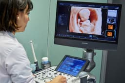 4D ultrazvuk dieťaťa v maternici. Foto: JAVIER LARREA / Sciencephoto / Profimedia